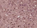 ADAM23 Antibody in Immunohistochemistry (Paraffin) (IHC (P))