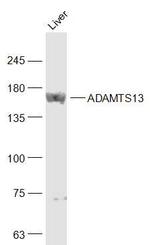 ADAMTS13 Antibody in Western Blot (WB)