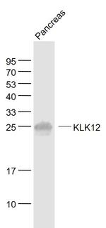 KLK12 Antibody in Western Blot (WB)