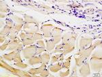 CTHRC1 Antibody in Immunohistochemistry (Paraffin) (IHC (P))