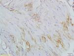 CTHRC1 Antibody in Immunohistochemistry (Paraffin) (IHC (P))