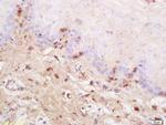 TSLC1 Antibody in Immunohistochemistry (Paraffin) (IHC (P))