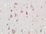 NARC1 Antibody in Immunohistochemistry (Paraffin) (IHC (P))