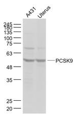 NARC1 Antibody in Western Blot (WB)