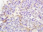 MTUS1 Antibody in Immunohistochemistry (Paraffin) (IHC (P))