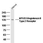 MTUS1 Antibody in Western Blot (WB)