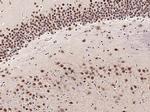 PHAP Antibody in Immunohistochemistry (Paraffin) (IHC (P))