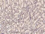 PHAP Antibody in Immunohistochemistry (Paraffin) (IHC (P))