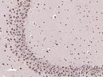 PHAP Antibody in Immunohistochemistry (Paraffin) (IHC (P))