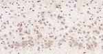 RSRC2 Antibody in Immunohistochemistry (Paraffin) (IHC (P))