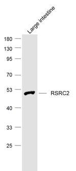 RSRC2 Antibody in Western Blot (WB)