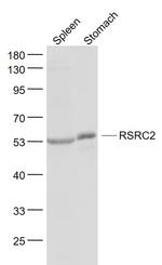 RSRC2 Antibody in Western Blot (WB)