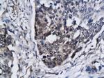 SIRT3 Antibody in Immunohistochemistry (Paraffin) (IHC (P))