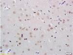 KDM5B Antibody in Immunohistochemistry (Paraffin) (IHC (P))