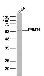 PRMT4 Antibody in Western Blot (WB)