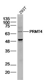 PRMT4 Antibody in Western Blot (WB)