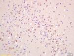 GNAQ Antibody in Immunohistochemistry (Paraffin) (IHC (P))