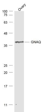 GNAQ Antibody in Western Blot (WB)