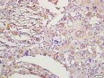 RAC1+RAC2 Antibody in Immunohistochemistry (Paraffin) (IHC (P))