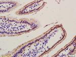 RAC1+RAC2 Antibody in Immunohistochemistry (Paraffin) (IHC (P))