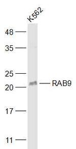 RAB9 Antibody in Western Blot (WB)