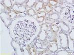 RAB20 Antibody in Immunohistochemistry (Paraffin) (IHC (P))