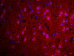 TGM2 Antibody in Immunohistochemistry (Paraffin) (IHC (P))