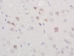 TGM2 Antibody in Immunohistochemistry (Paraffin) (IHC (P))