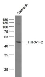 THRA1/2 Antibody in Western Blot (WB)