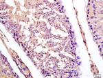 CT13 Antibody in Immunohistochemistry (Paraffin) (IHC (P))