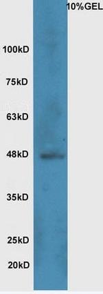 Wnt8b Antibody in Western Blot (WB)
