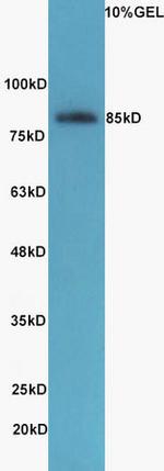 SIK1 Antibody in Western Blot (WB)