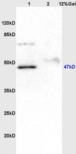 KIST Antibody in Western Blot (WB)