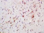 FUT8 Antibody in Immunohistochemistry (Paraffin) (IHC (P))