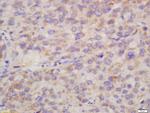 Hepsin Antibody in Immunohistochemistry (Paraffin) (IHC (P))