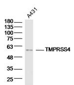 TMPRSS4 Antibody in Western Blot (WB)