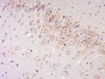 IFN-Alpha Antibody in Immunohistochemistry (Paraffin) (IHC (P))