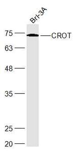 CROT Antibody in Western Blot (WB)