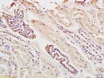 Ferritin Light Chain Antibody in Immunohistochemistry (Paraffin) (IHC (P))