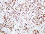 Phospho-PI3 Kinase p110 beta (Ser1070) Antibody in Immunohistochemistry (Paraffin) (IHC (P))