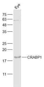 Retinol Binding Protein Antibody in Western Blot (WB)