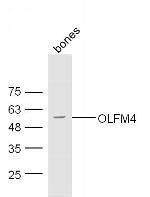 OLFM4 Antibody in Western Blot (WB)