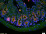 PAI1 Antibody in Immunohistochemistry (Paraffin) (IHC (P))