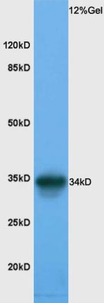 RPL5 Antibody in Western Blot (WB)