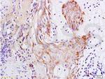 S100A15 Antibody in Immunohistochemistry (Paraffin) (IHC (P))