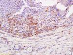 Desmoglein 3 Antibody in Immunohistochemistry (Paraffin) (IHC (P))