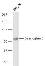 Desmoglein 3 Antibody in Western Blot (WB)