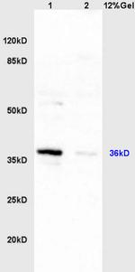 HSD17B1 Antibody in Western Blot (WB)