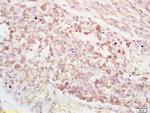 PAPPA Antibody in Immunohistochemistry (Paraffin) (IHC (P))