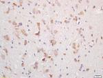 MCHR Antibody in Immunohistochemistry (Paraffin) (IHC (P))